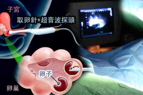 代孕公司供卵,天津医院助孕服务-正规助孕网